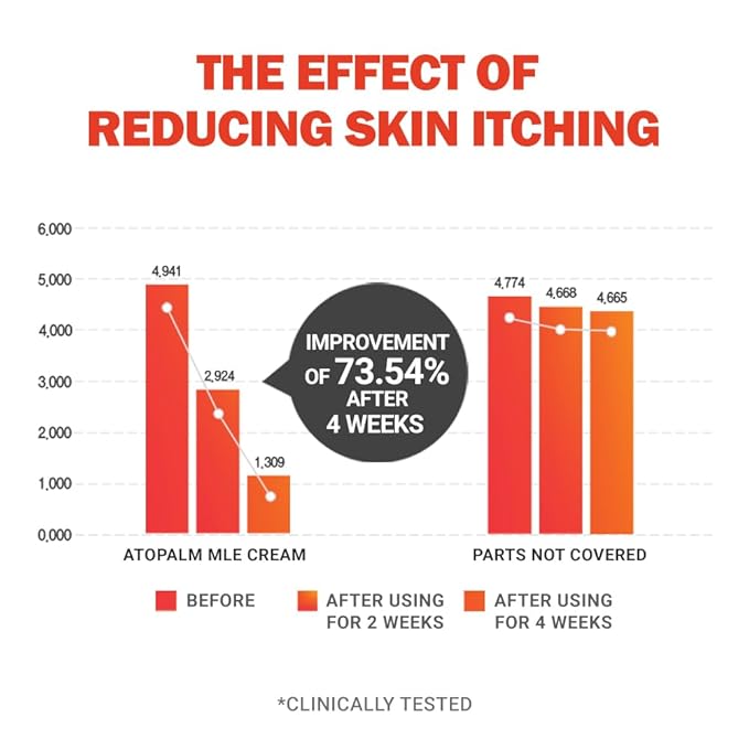 ATOPALM | MLE Eczema Cream | Premium Baby Face Cream | Body Moisturizer for Skin Barrier | Baby Lotion for Relieving Itchiness & Redness | Eczema Cream for Sensitive Skin | 5.6 fl oz (160ml)