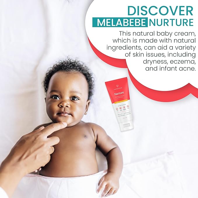 Nurture: Daily Moisturizing Cream - Baby Eczema Cream & Baby Lotion Sensitive Skin Baby Cream - Natural Baby Lotion and Baby Moisturizer Infused w/Shea, Aloe Vera & Jojoba Oils - 6oz