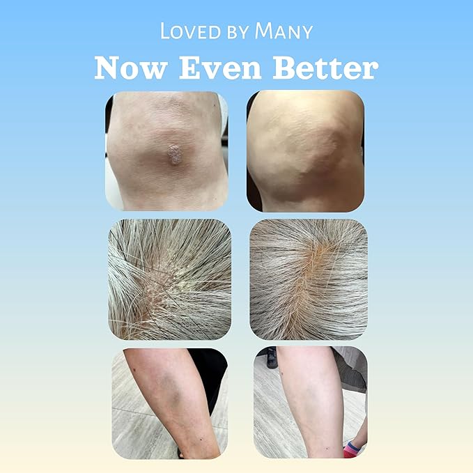 Natural SKIN REPAIR. Clinically tested Aromatherapy. Powerful Essential Oil. Eczema, Dermatitis, Diaper rash, and Sensitive skin. For all skin types. Hypoallergenic, Vegan, Paraben Free. 50ml bottle