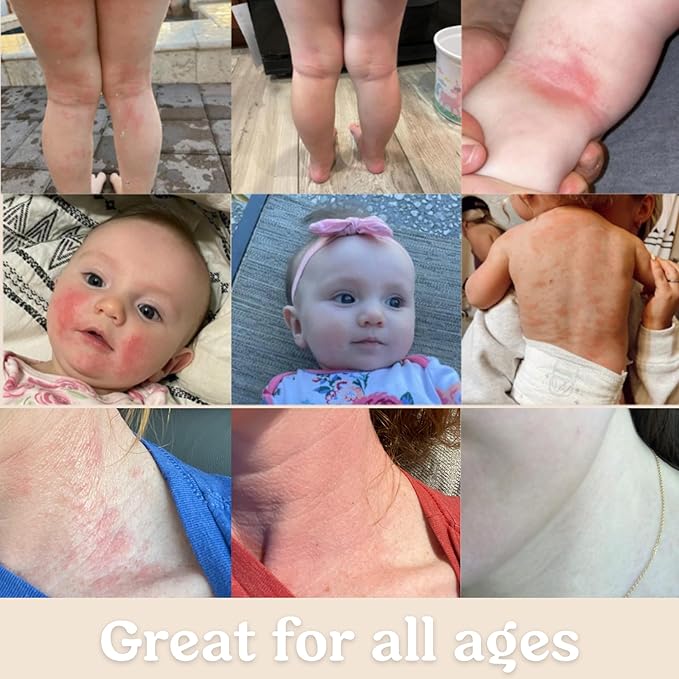 Roe Wellness- Baby Cream Lotion Ointment | Full Body Biome Barrier Cream | Clean Ingredients, Dry Skin, Itch Relief, Moisturizing, All Over Ointment | Toddlers & Kids