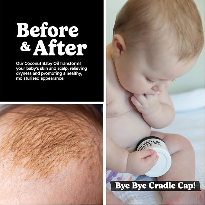 Coconut Baby Oil for Hair & Skin Care, Natural & Organic, Coconut Oil for Cradle Cap, Eczema, Infant Scalp Relief, Hair Oil for Curly Hair - Newborn Moisturizer for Sensitive Skin, Unscented - 2 fl oz